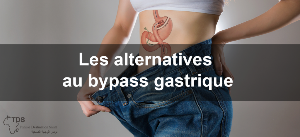 Blog Chirurgie Bariatrique Solutions Avec Sleeve Bypass Ballon Gastrique