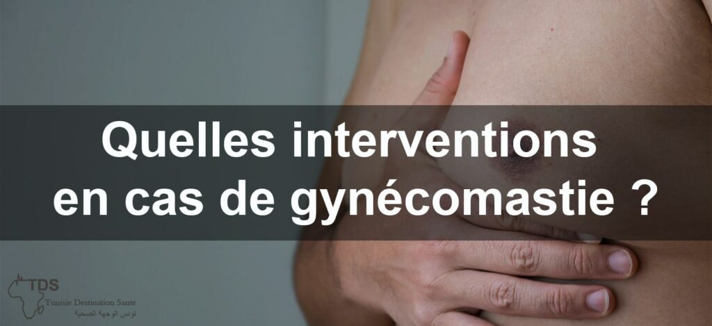 Gynécomastie Solutions et Interventions