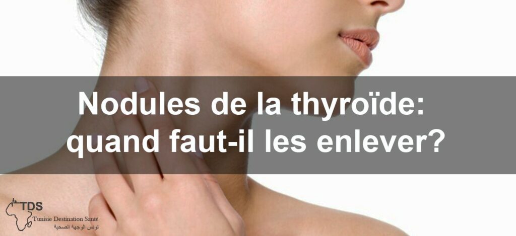 Nodules De La Thyro De Crit Res D Ablation Et D Cisions M Dicales