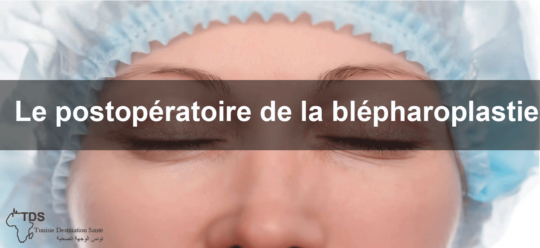 Bl Pharoplastie Conseils Pour La P Riode Postop Ratoire