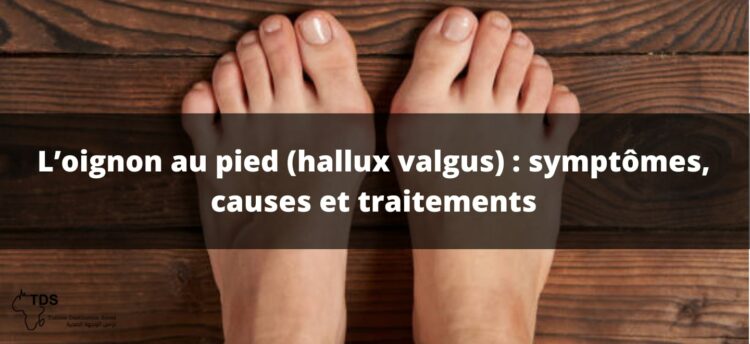 Hallux Valgus Les Causes D Un Oignon Au Pied