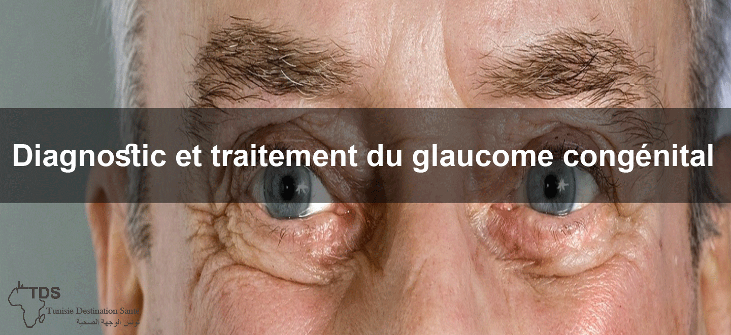 Diagnostic Et Traitement Du Glaucome Congenital Blog Destination Sante