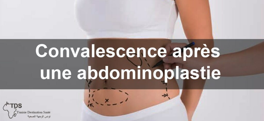 Convalescence Après une Abdominoplastie : Conseils Essentiels