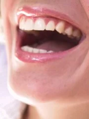 Un implant dentaire