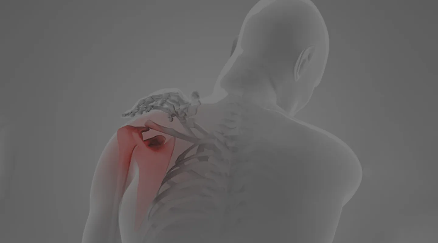 Chirurgie de l’épaule