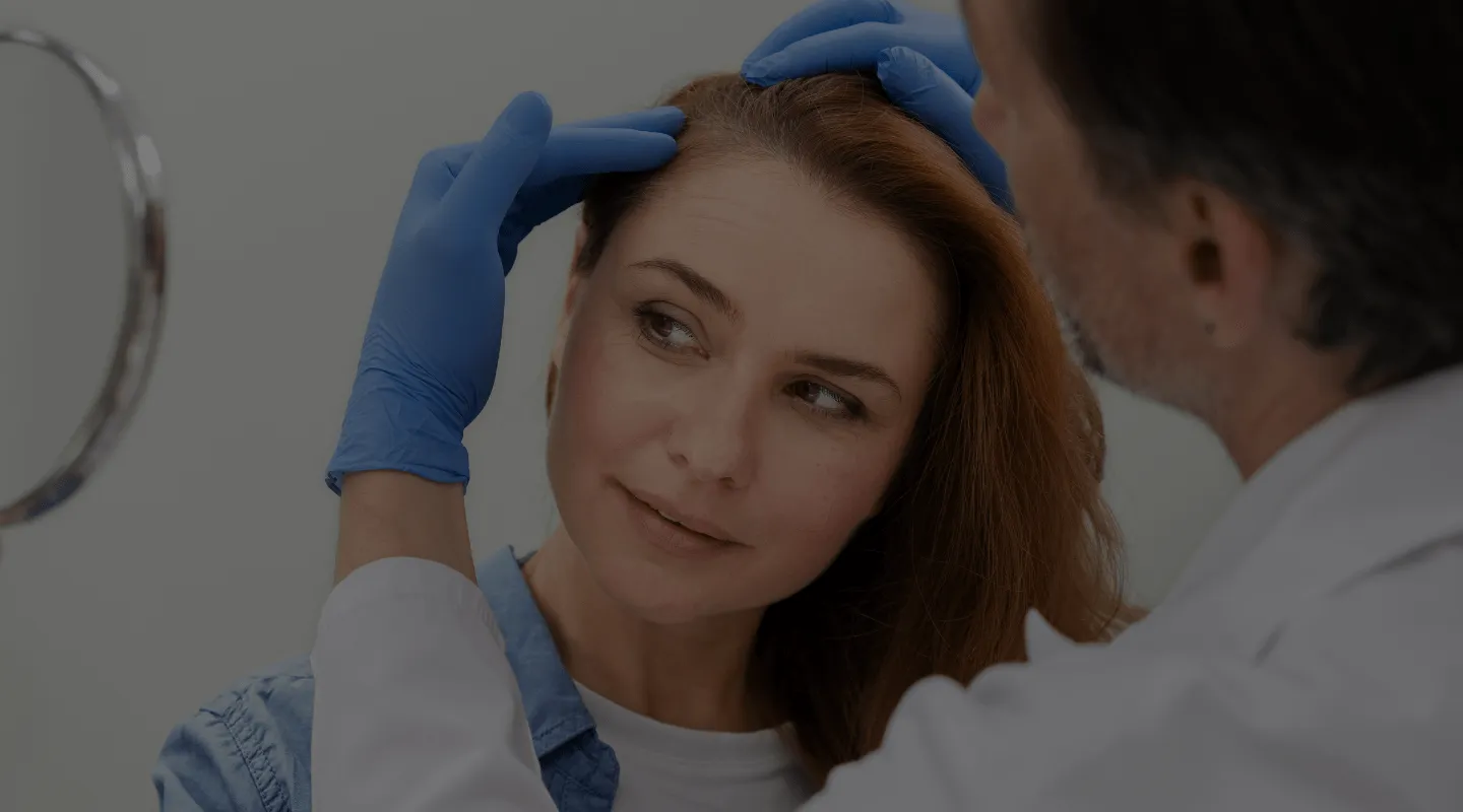 Greffe de cheveux Femme