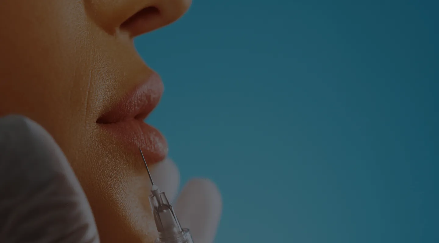 Injection d'acide hyaluronique