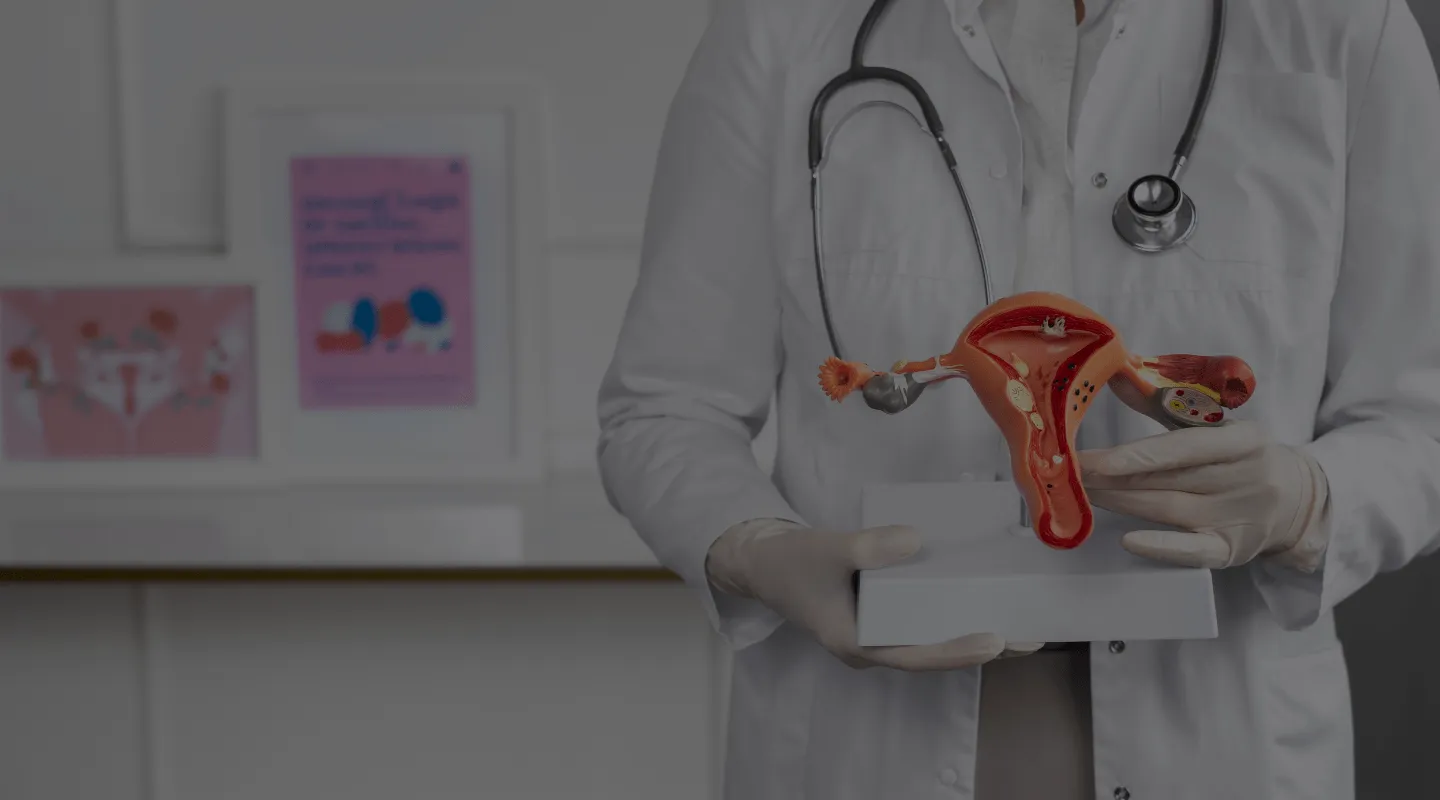 Chirurgie du Kyste de l’ovaire