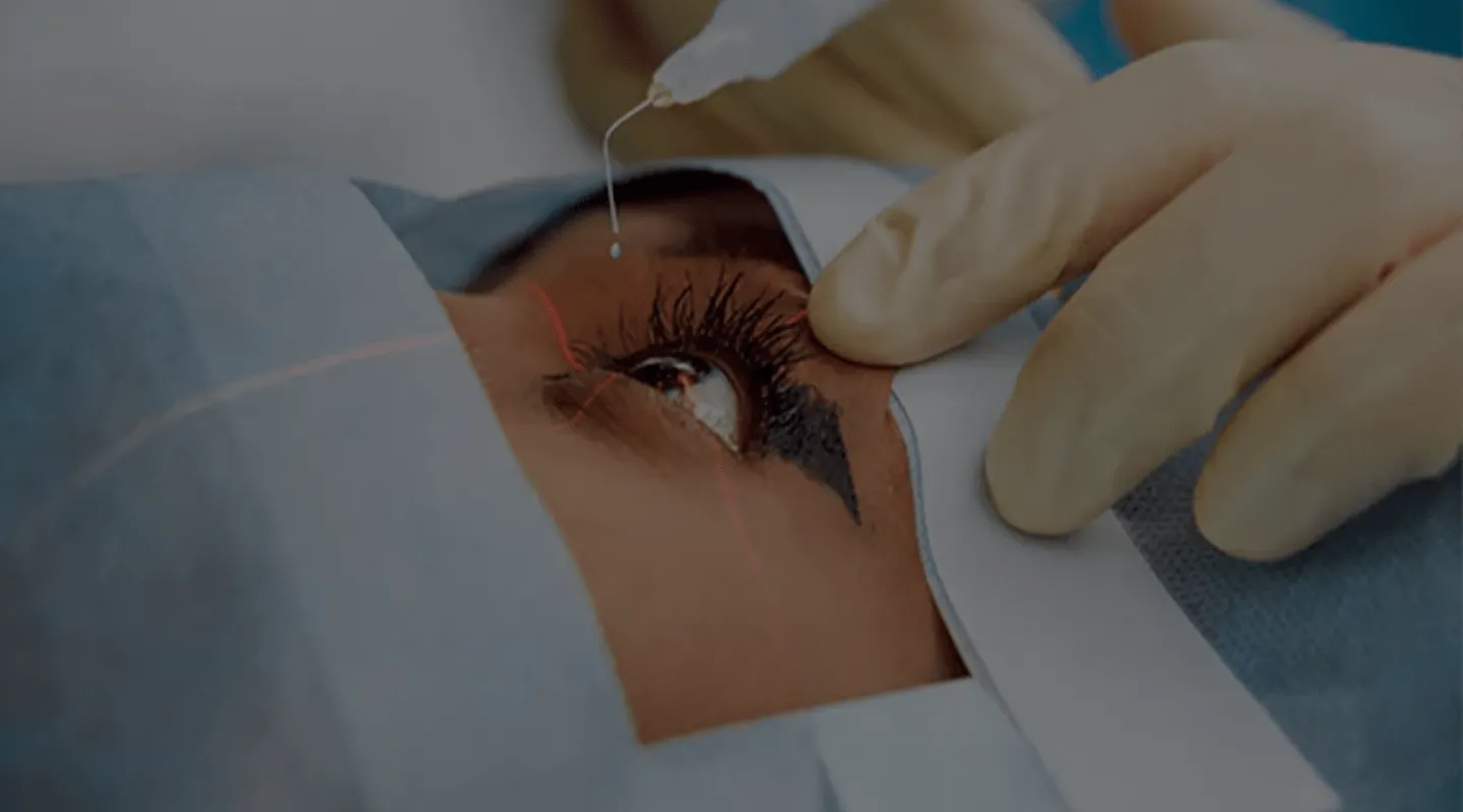 Photocoagulation au laser