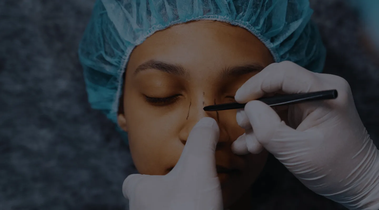 Rhinoplastie