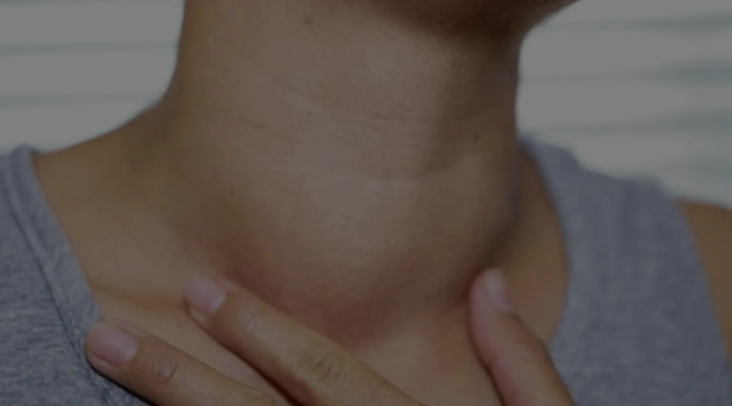 Opération de la thyroïde