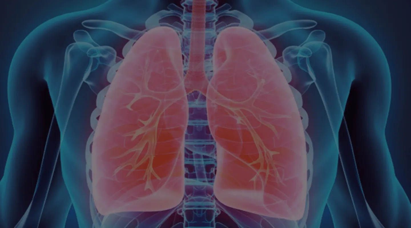 Pneumonectomie