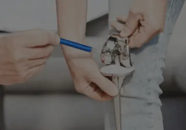 FAQ Prothèse du Genou