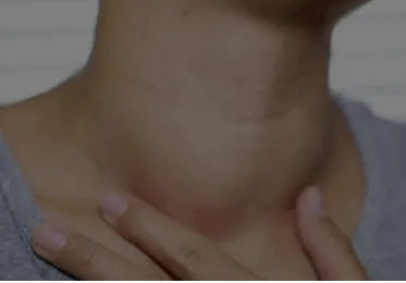 FAQ Thyroïde